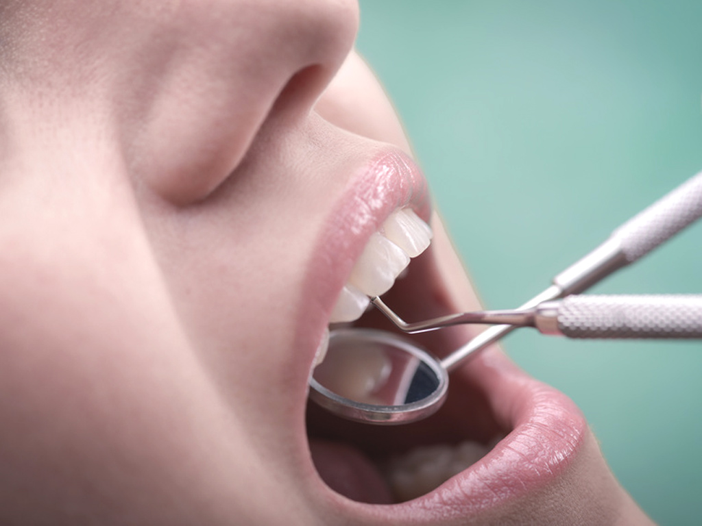 Santé bucco dentaire. Prendre soin de ses dents, les bons gestes à adopter