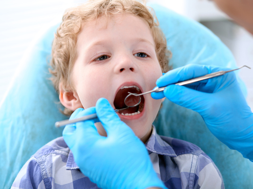 caries précoces chez les tout-petits, les enfants