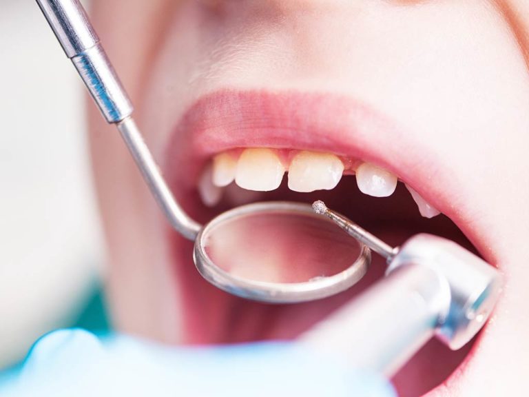 3 questions pour vous aider à trouver le dentiste qu'il vous faut